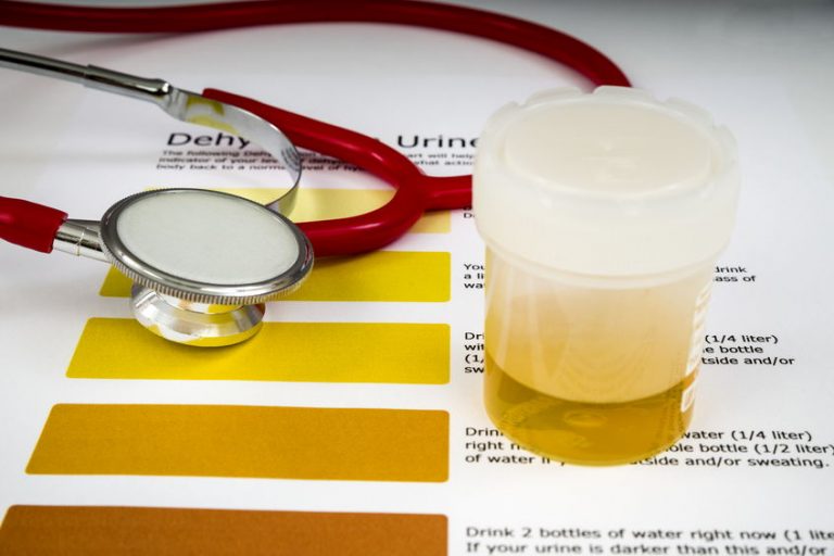 Urine Toxicology Testing Beechtree Diagnostics